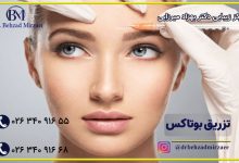 تزریق بوتاکس در کلینیک دکتر میرزایی