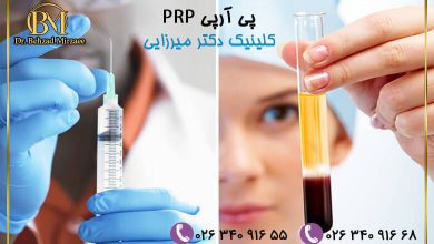 پی آر پی (prp) کلینیک دکتر میرزایی