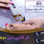 لیزر بعد از چند جلسه جواب می دهد؟