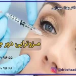 بهترین مرکز مزوتراپی چشم در فردیس
