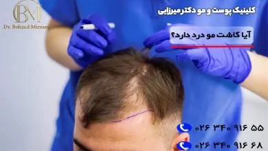 hair transplant pain