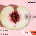 تزریق چربی به واژن در فردیس {مراحل و اقدامات و فواید تزریق چربی به واژینال}