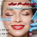 تزریق فیلر خط خنده + فیلم فیلر خط خنده