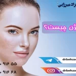 سابسیژن با کانولا برای رفع اسکار | مراقبت‌ها و مزایا