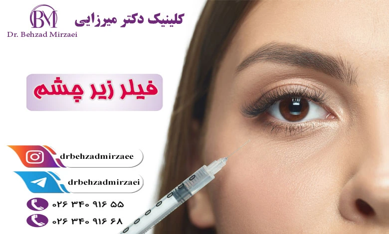 چگونه تزریق ژل می تواند گودی و تیرگی زیر چشم را از بین ببرد؟