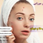 جوش ها و روشهای تخصصی درمان جوشها
