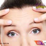 بهترین روشها برای درمان و رفع چروک پیشانی