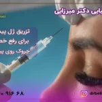 تزریق ژل به پیشانی برای رفع خط اخم و چین و چروک