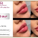 ماندگاری ژل لب چقدر است ؟ | راهکارهای افزایش ماندگاری