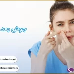 پرسشهای متداول لیزر و جوش های بعد از لیزر