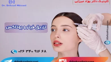 ژل یا بوتاکس؟