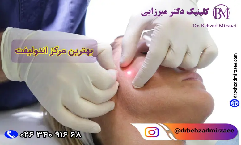 اندولیفت: روش نوین برای جوانسازی پوست