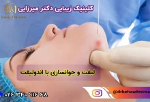 بهترین مرکز اندولیفت در فردیس