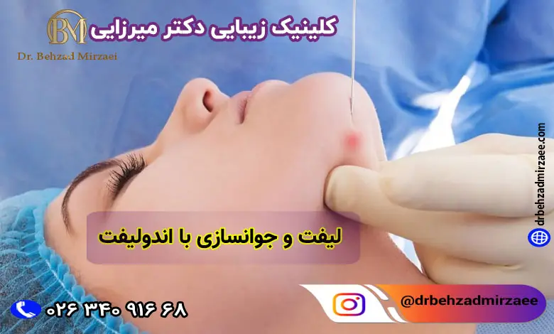 بهترین مرکز اندولیفت در فردیس