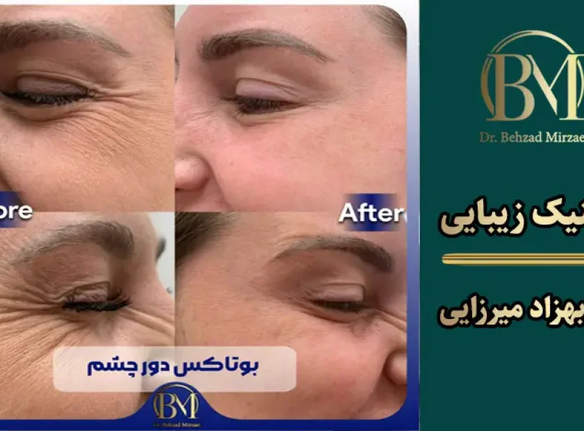 کلینیک زیبایی دکتر بهزاد میرزایی - زیبایی و جوانی 13 maghale46 1