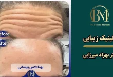 بهترین مرکز تزریق بوتاکس در فردیس