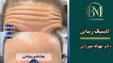 بهترین مرکز تزریق بوتاکس در فردیس