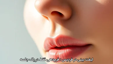 لیفت بینی در فردیس